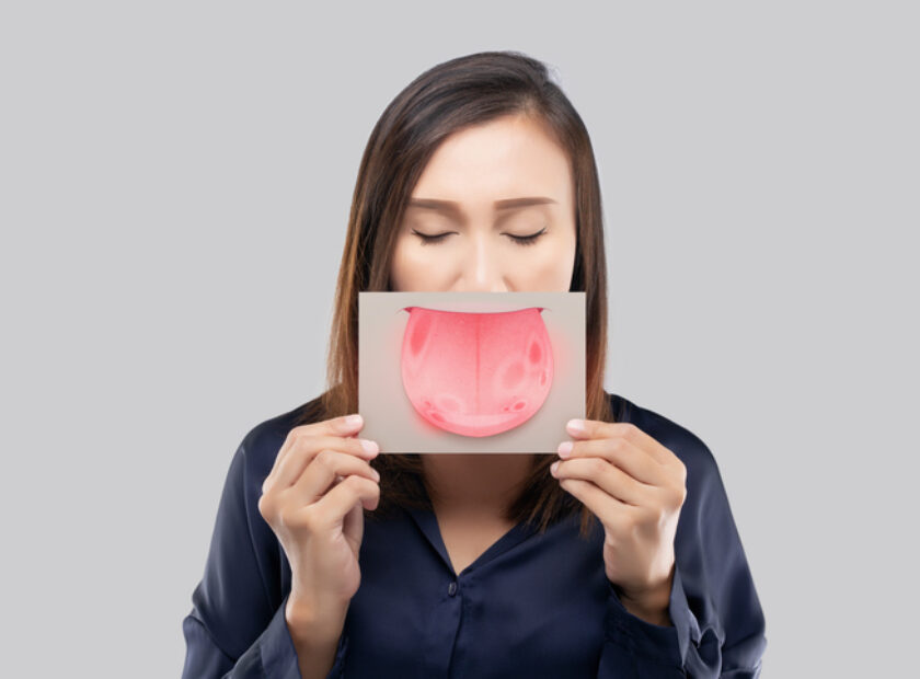 Tongue problems