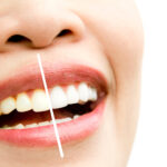 ¿Por qué algunas personas tienen los dientes más amarillos que otras (y qué hacer al respecto)?